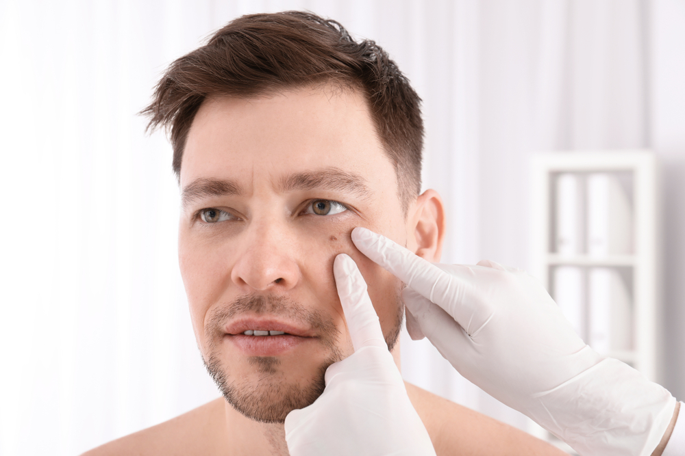 Lumps, Bumps, and Biopsies in Houston and Greater Houston, TX