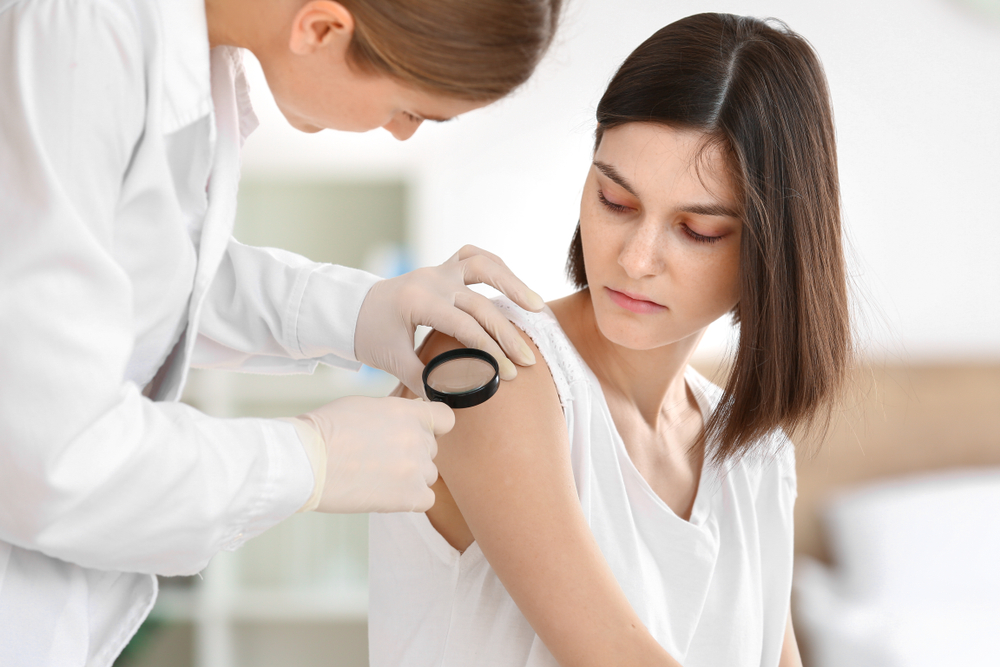 Eczema Treatment Image