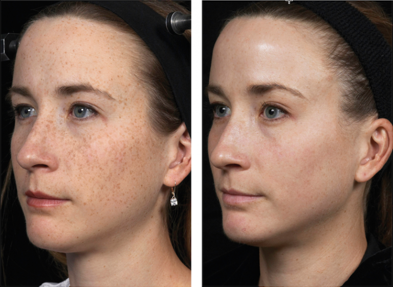 Make Skin Toning with DermSurgery Your Priority This Month ...