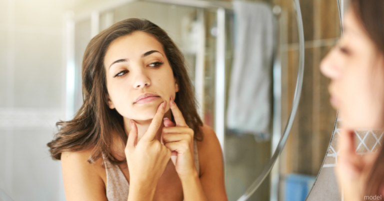 (QUIZ) What Is the Best Acne Treatment for You? | DermSurgery Associates