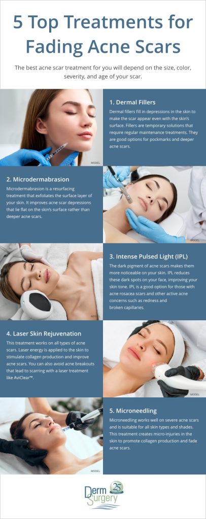 What Helps With Acne Scars? Treatment Options (INFOGRAPHIC)  DermSurgery Associates