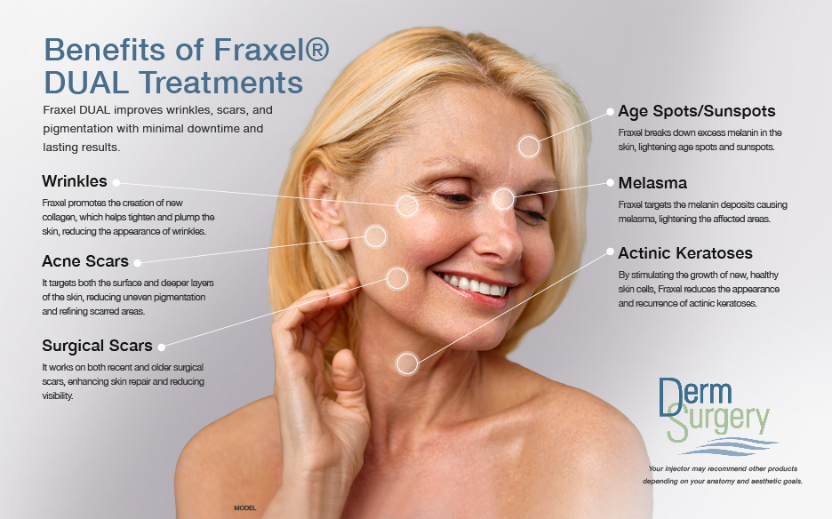 Diagram of Benefits of Fraxel Dual Treatments