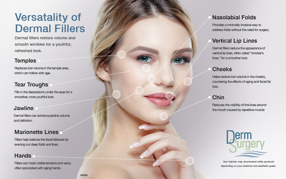 Diagram of versitility of dermal fillers